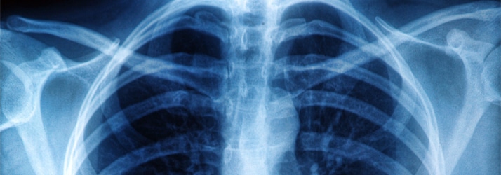 Chiropractic Commerce Township MI Chest X-Ray Chiropractic Commerce Township MI Chest X-Ray